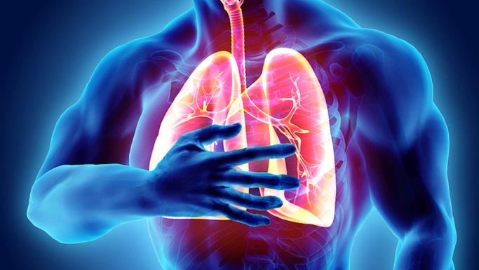 What is a Pulmonary Embolism